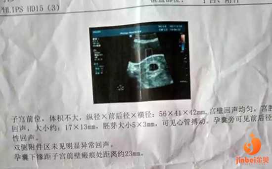 上海供卵中心哪里可靠_【常州供卵试管婴儿费用】来补贴，22岁宝妈顺产经历